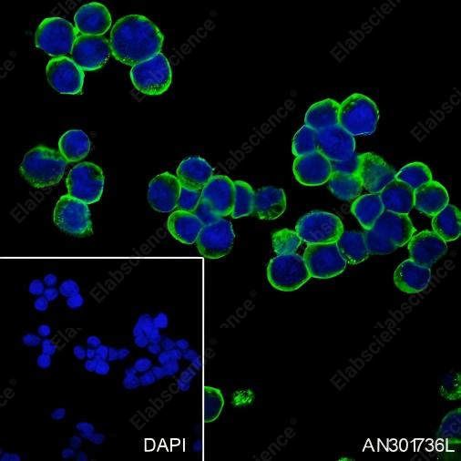 Recombinant CCR7 Monoclonal Antibody - 2