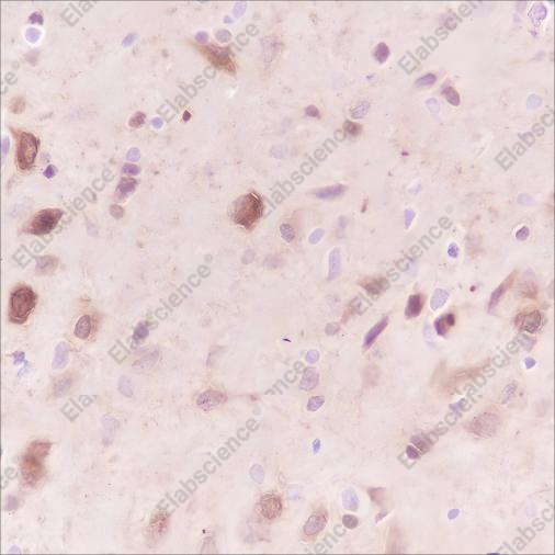 Recombinant Stathmin Monoclonal Antibody - 5