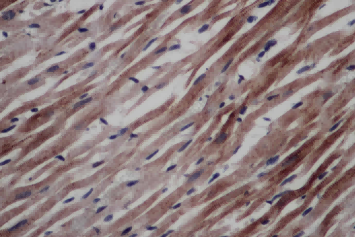 CD297 Polyclonal Antibody - 2