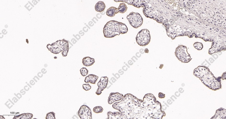 Recombinant CD105 Monoclonal Antibody - 2
