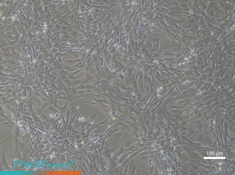 Rat Pulmonary Artery Smooth Muscle (Primary cell immortalization) Cell Complete MediumRat Pulmonary Artery Smooth Muscle (Primary cell immortalization) Cell Complete Medium - 3