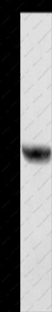HSD17B1 Polyclonal Antibody - 1