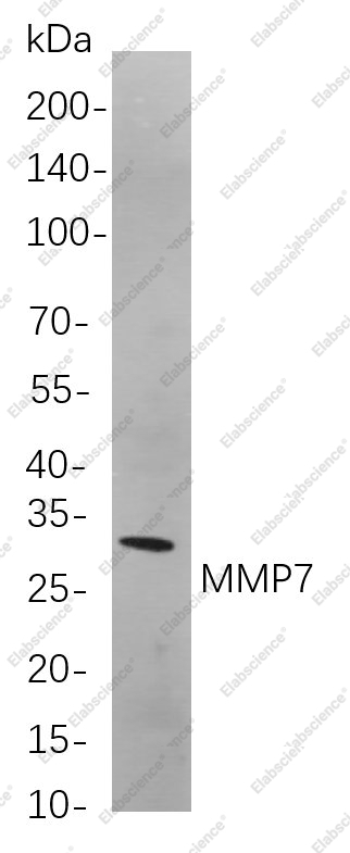 Recombinant MMP7 Monoclonal Antibody - 1