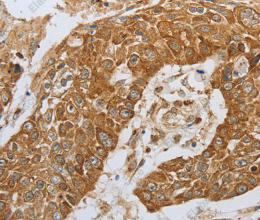 CKM Polyclonal Antibody - 2