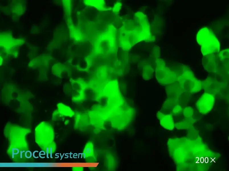 MCF7-LUC-EGFP Cell Complete Medium - small - 4