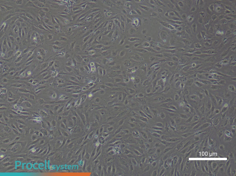 Human Pulmonary Arteriolar Endothelial Cell Complete Medium - 1