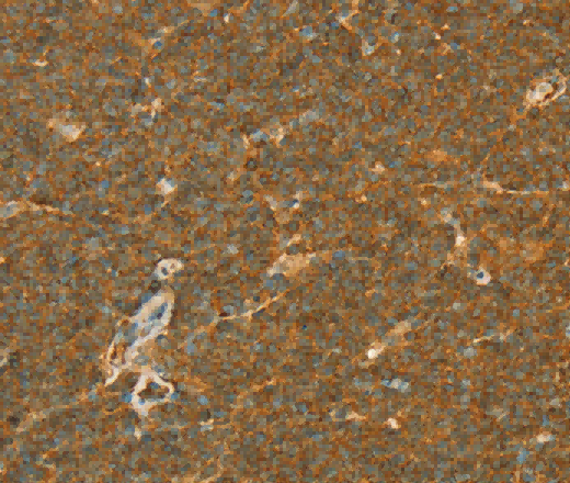 APOL2 Polyclonal Antibody - 3