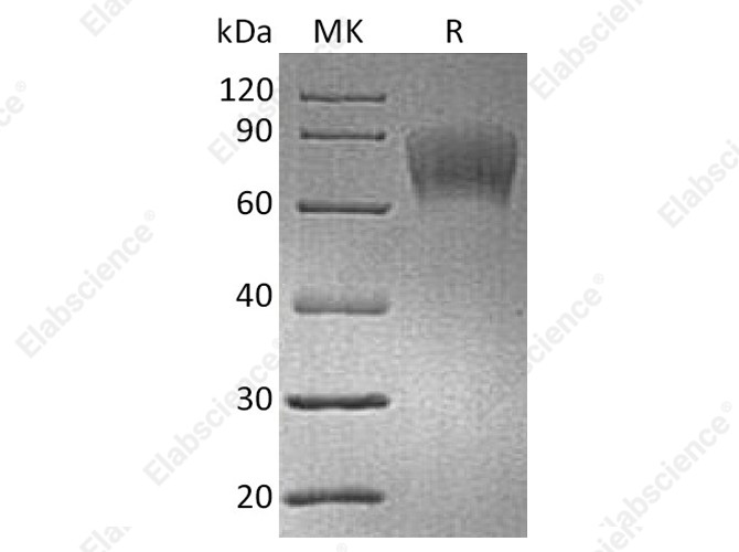 Recombinant Human CD30/TNFRSF8 Protein (His & Avi Tag) - 1