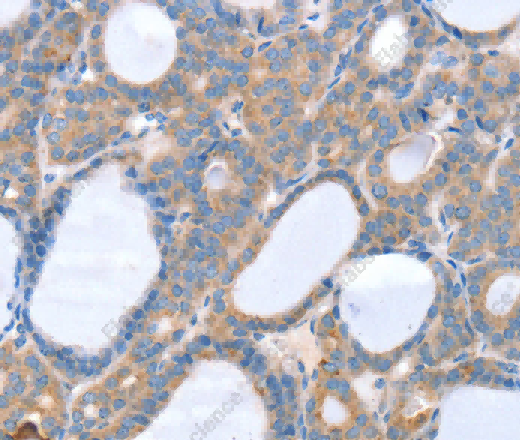 SLC25A13 Polyclonal Antibody - 2