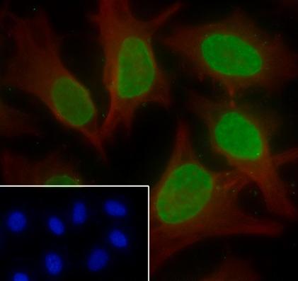 Recombinant Histone H3 (Di Methyl Lys56) Monoclonal Antibody - small - 5