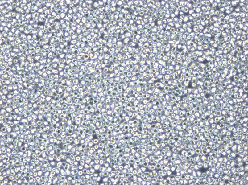 NOMO-1 Cell Complete Medium - small - 5