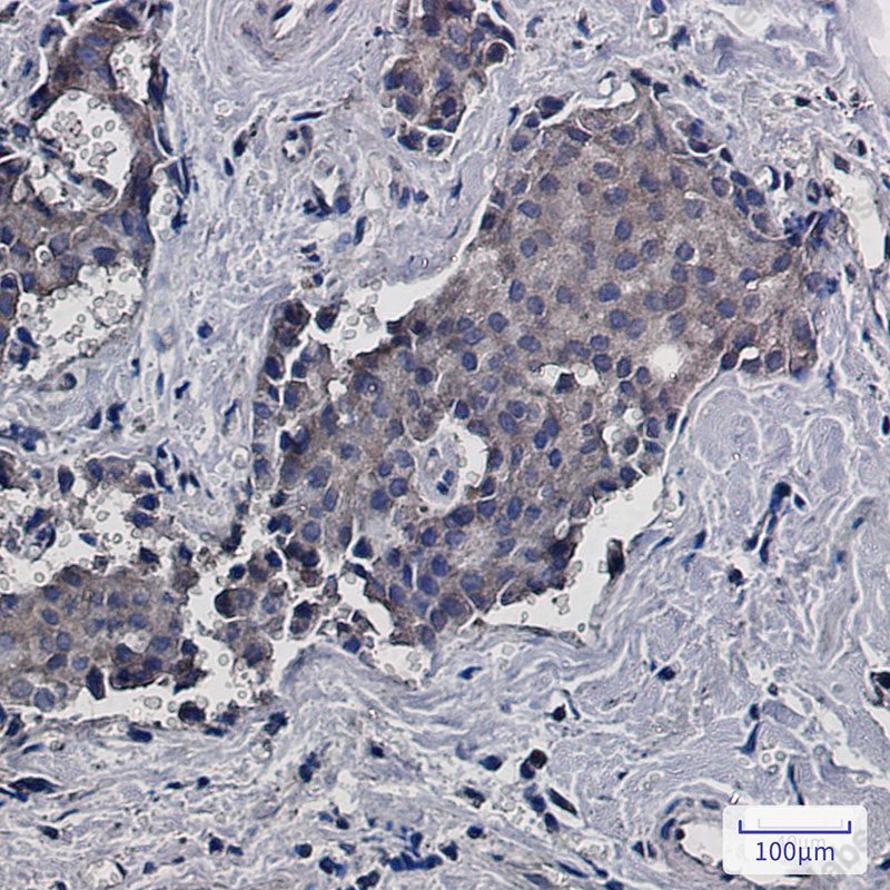 Recombinant RACK1 Monoclonal Antibody - 3