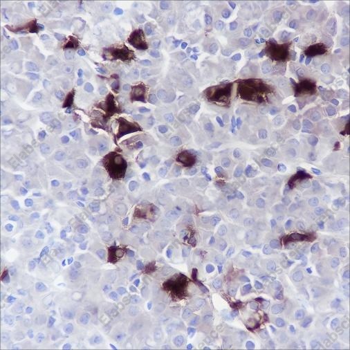 Recombinant TSHB Monoclonal Antibody - 2