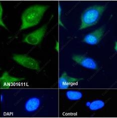 Recombinant NSE Monoclonal Antibody - 1