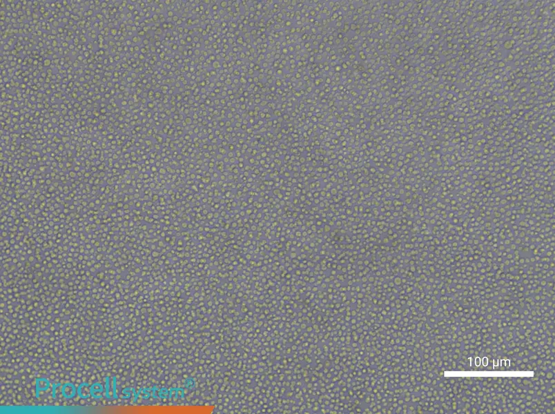 CCRF-CEM [CCRF CEM]CCRF-CEM [CCRF CEM] - 3