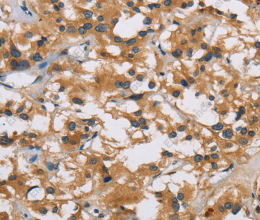 IL19 Polyclonal Antibody - 2