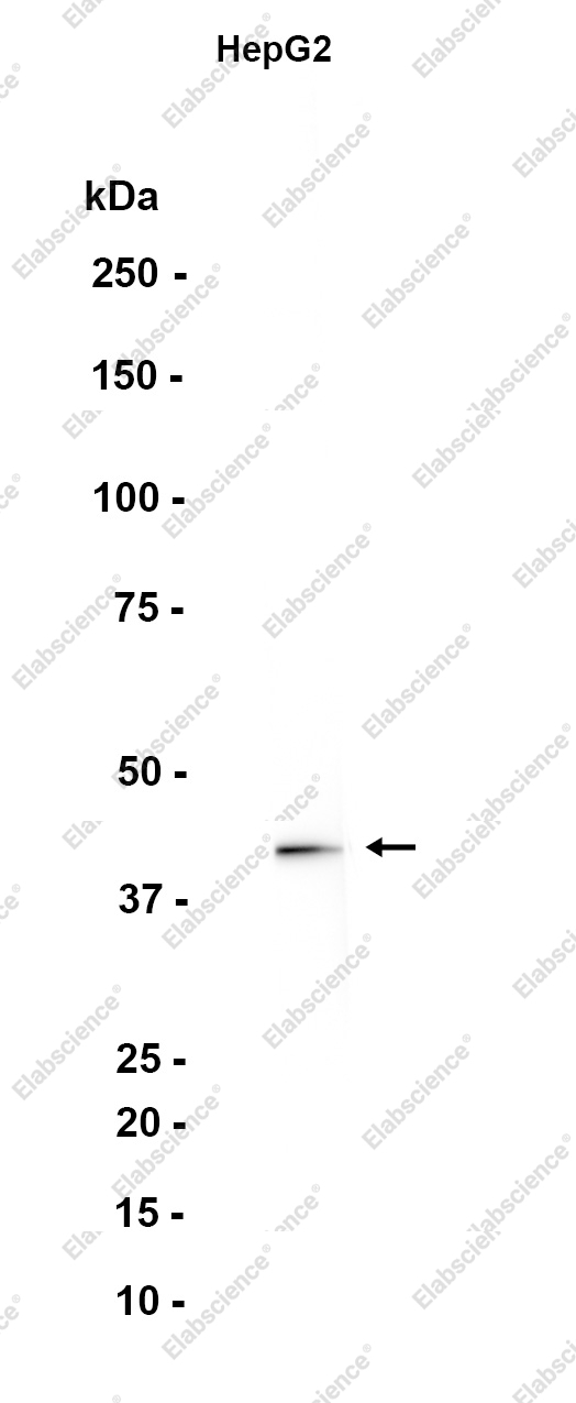 Recombinant Apolipoprotein L1 Monoclonal Antibody - 1