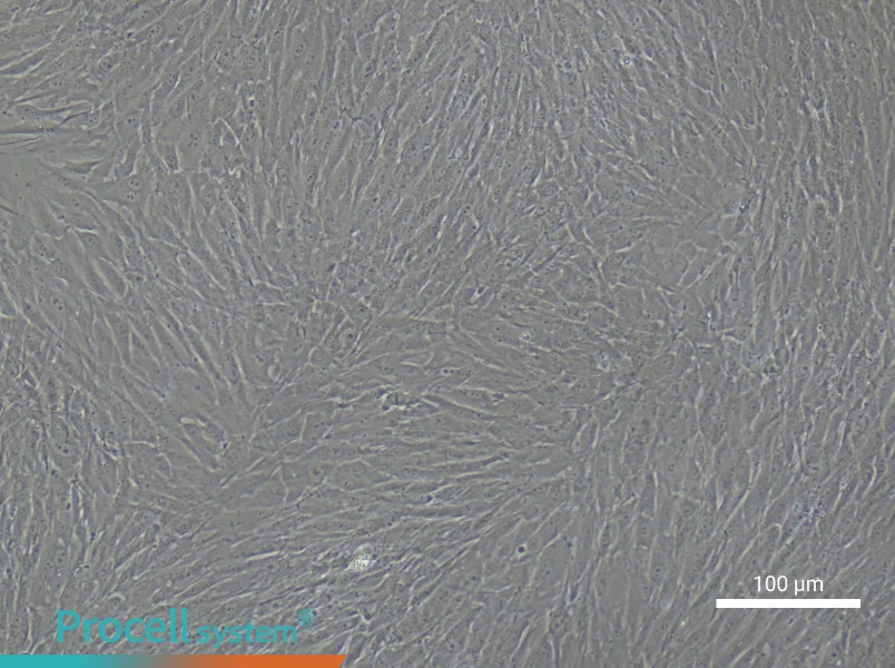 Human Cardiac Fibroblast Complete MediumHuman Cardiac Fibroblast Complete Medium - 2