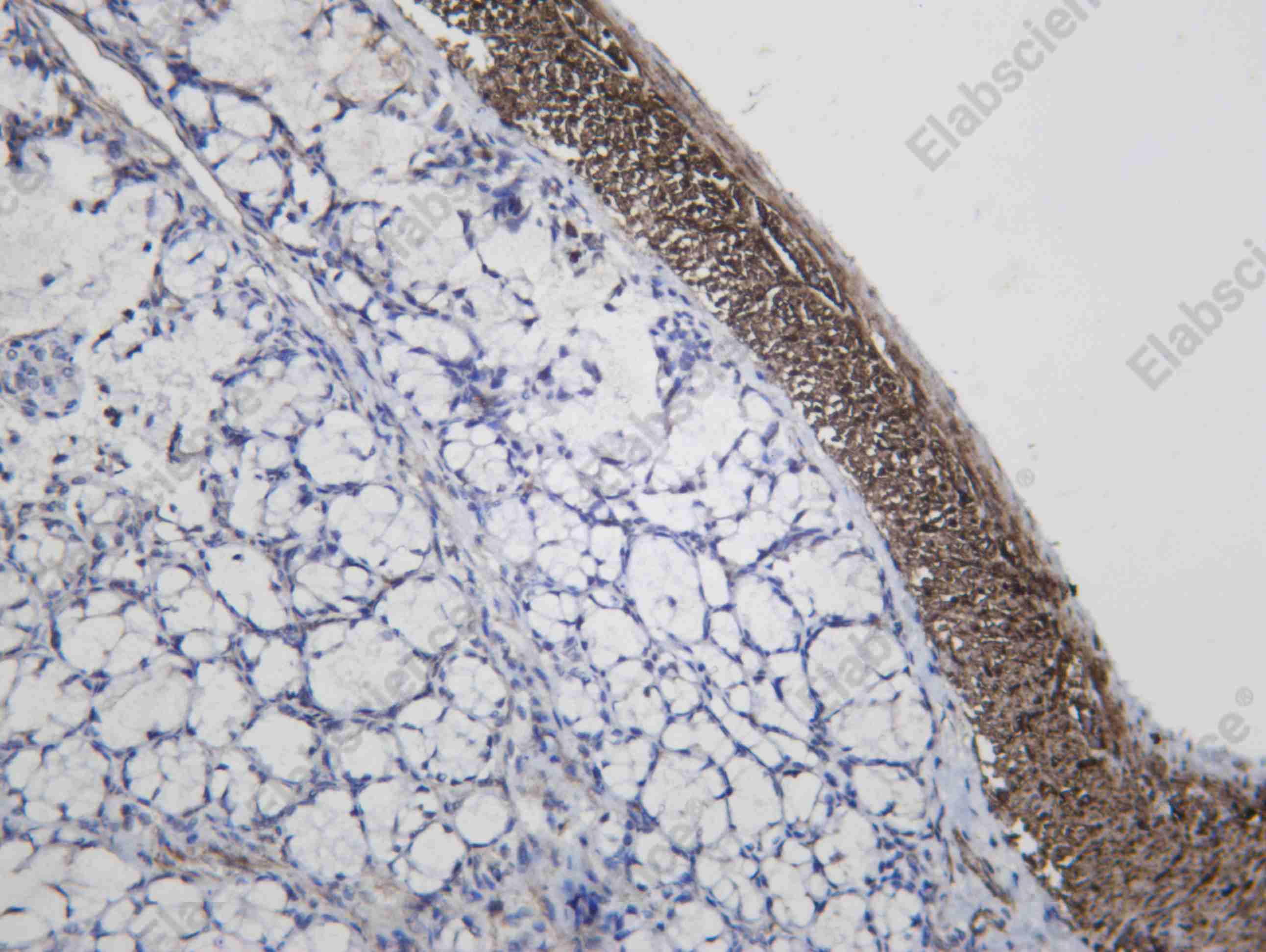 Recombinant SMIF Monoclonal Antibody - 2