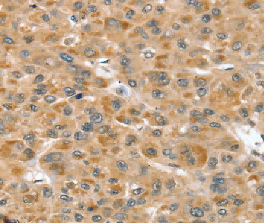 RNH1 Polyclonal Antibody - 2