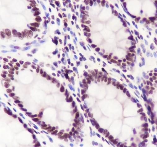 Recombinant SMARCA2/BRM Monoclonal Antibody - 3