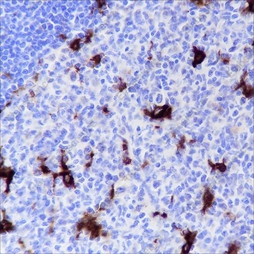 Recombinant GPNMB Monoclonal Antibody - 2