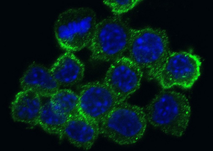 Recombinant MSR1/CD204 Monoclonal Antibody-searchlist-1