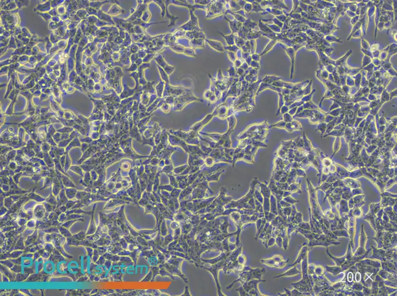 22RV1 Cell Complete Medium - small - 6