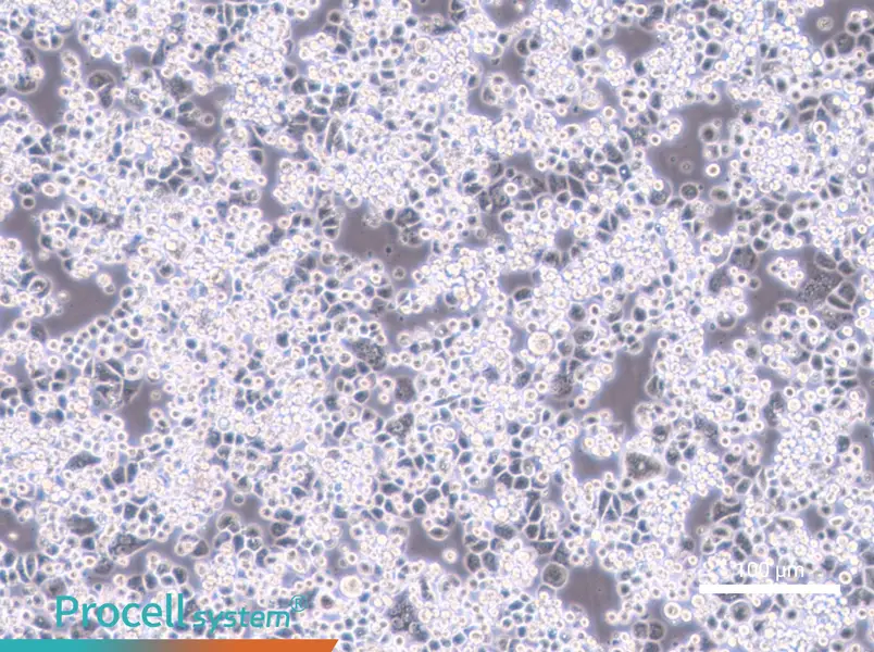 MDA-kb2MDA-kb2 - 2