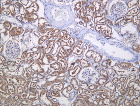 Recombinant PFK-B Monoclonal Antibody - 1