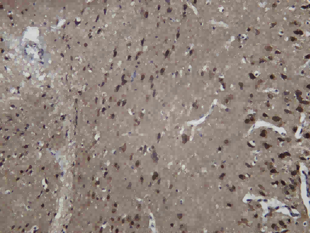 Recombinant Presenilin 1 Monoclonal Antibody - 3
