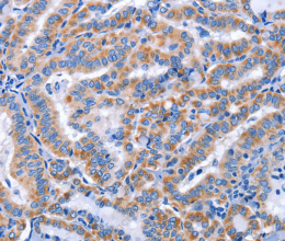 CCR6 Polyclonal Antibody - 2