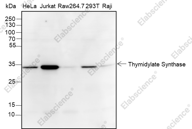 Recombinant Thymidylate Synthase Monoclonal Antibody - 1