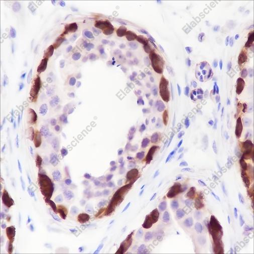 Recombinant MAGEA1 Monoclonal Antibody - 2