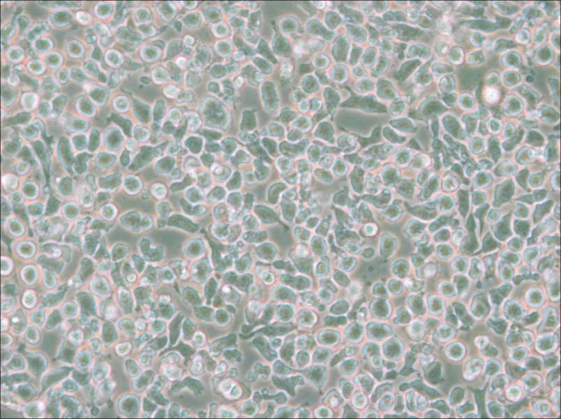 MM.1S Cell Complete Medium - 5