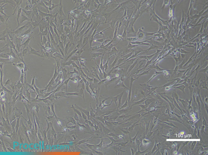 Rat Brain Microvascular Pericyte Complete Medium - 1