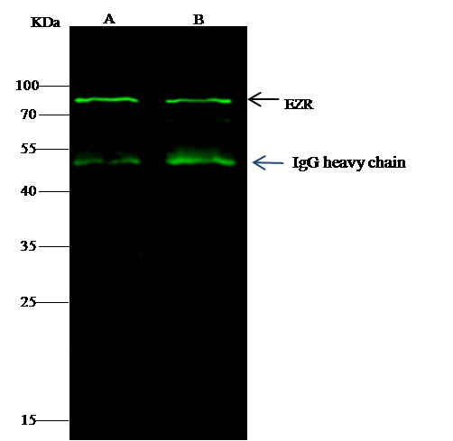 Ezrin/villin 2/EZR Monoclonal Antibody - small - 2