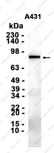 Recombinant BAP1 Monoclonal Antibody - 2