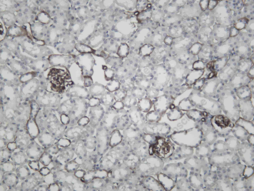 Recombinant CD239 Monoclonal Antibody - 3