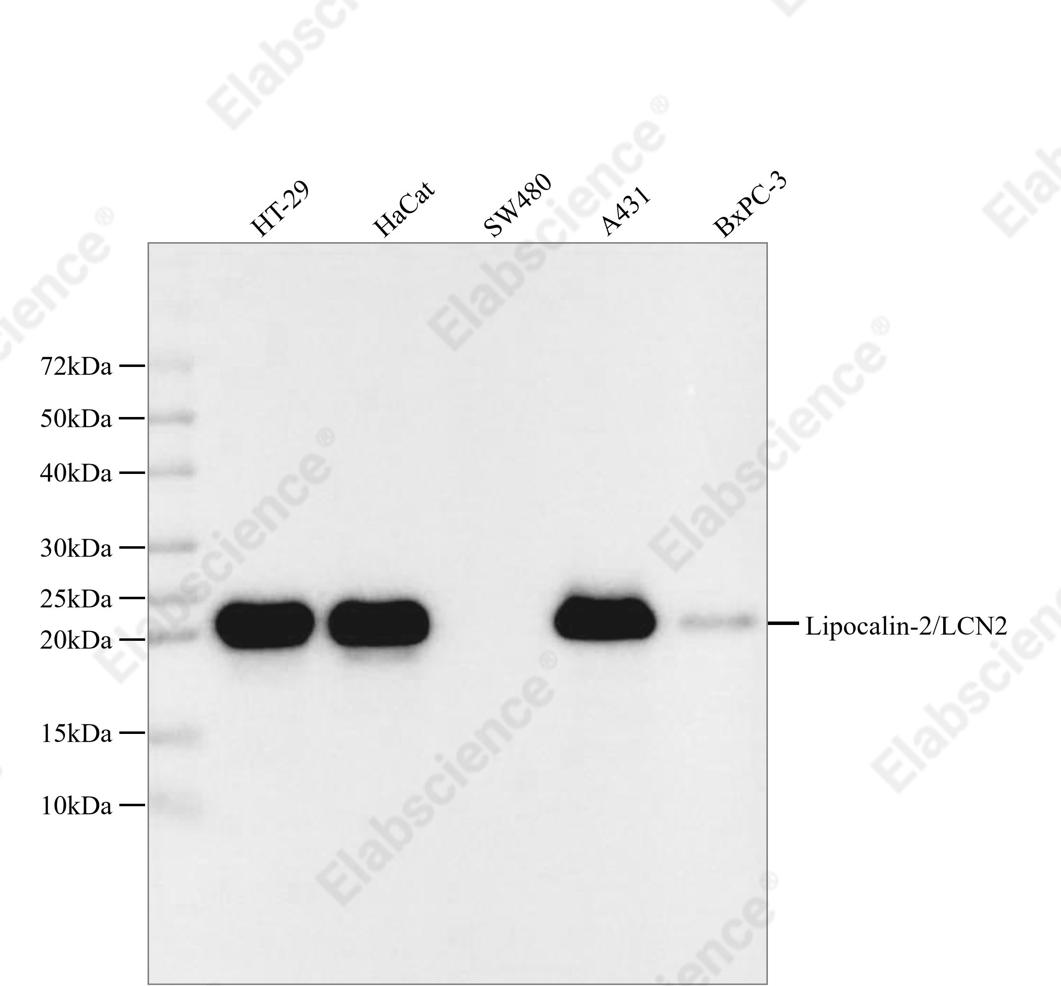 Recombinant Lipocalin-2/LCN2 Monoclonal Antibody - 1