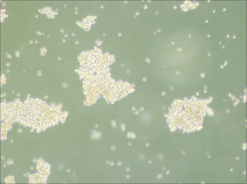 NCI-H69 Cell Complete Medium - small - 2