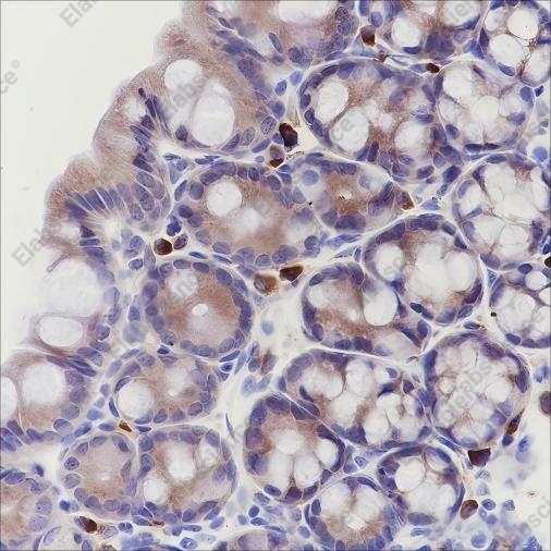 Recombinant eIF3B Monoclonal Antibody - 3