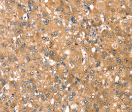 RPS6KA1 Polyclonal Antibody - 2