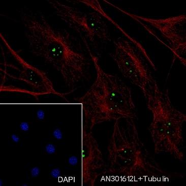 Recombinant NPM1 Monoclonal Antibody - small - 6