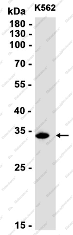 Recombinant Cathepsin Z Monoclonal Antibody - 2
