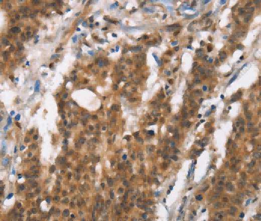 BCAS4 Polyclonal Antibody - 2