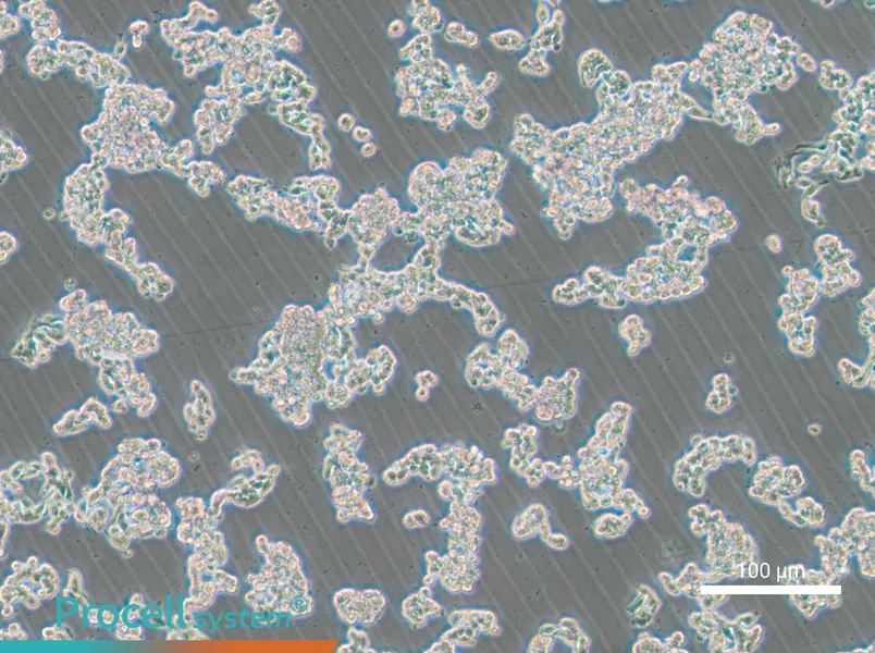 HCC1187HCC1187 - 2