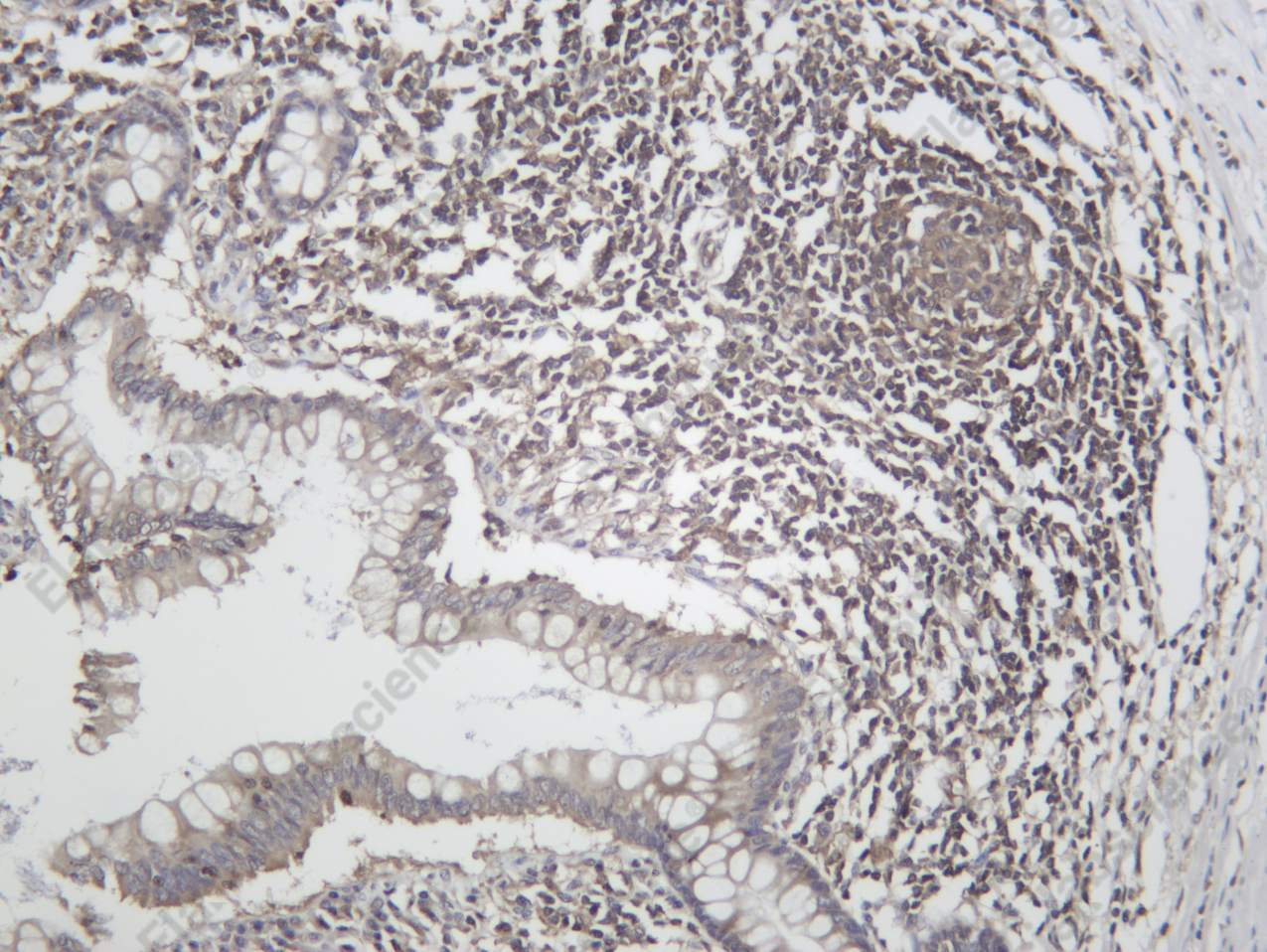 Recombinant IRAK4 Monoclonal Antibody - 2