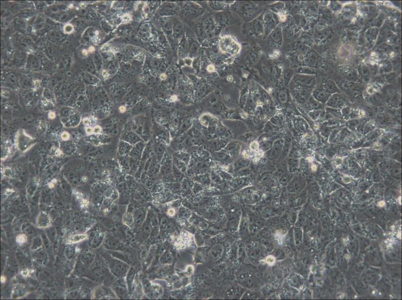 NTERA-2 Cell Complete Medium - small - 4