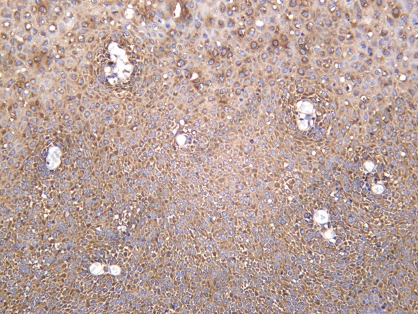 Recombinant LGR6 Monoclonal Antibody - 1